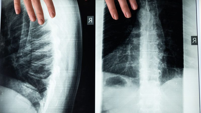 A radiograph being reviewed in a clinical setting